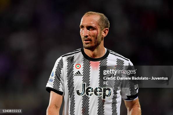 ACF Fiorentina v Juventus - Serie A ACF Fiorentina v Juventus - Serie A