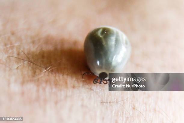 Fed tick is seen on a human skin in this illustration photo taken in Poland on May 21, 2022.