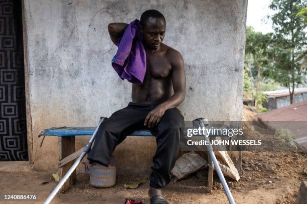 Sheku Turay rests after making his way up the mountain to his home in Freetown on April 12, 2022. - Sheku owns a prosthetic leg but he cant use it on...