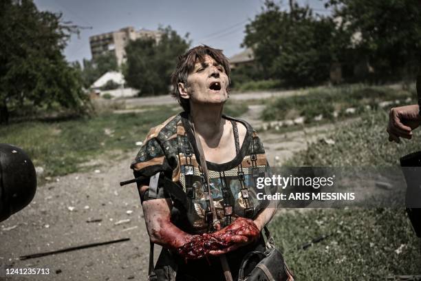 Graphic content / TOPSHOT - A wounded woman reacts as she is treated by Ukrainian servicemen during an artillery duel between Ukrainian and Russian...