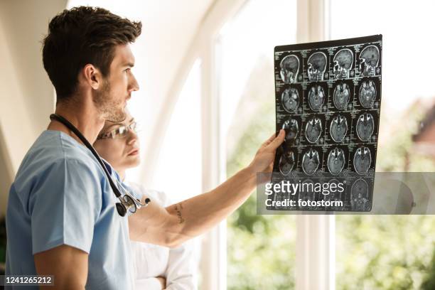 oncologists looking at x-ray scans of a brain tumor - skull xray no brain stock pictures, royalty-free photos & images