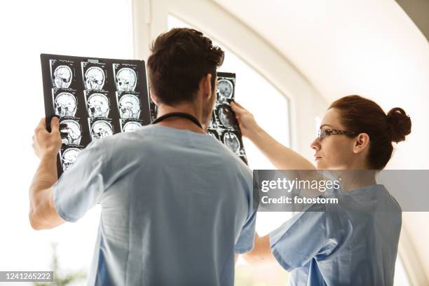 two neurosurgeons analyzing x-rays of a patient with brain tumor - skull xray no brain stock pictures, royalty-free photos & images