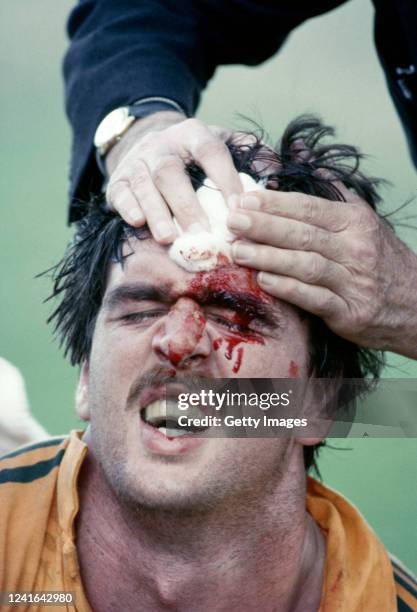 Australia lock Steve Cutler has a bloodied head wound looked at during the Second Test match between Australia and New Zealand at Ballymore Stadium...
