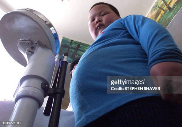 Young boy steps onto the scales for a pretreatment weigh-in before undergoing acupuncture as a form of treatment for severe obesity 02 April 1999 at...