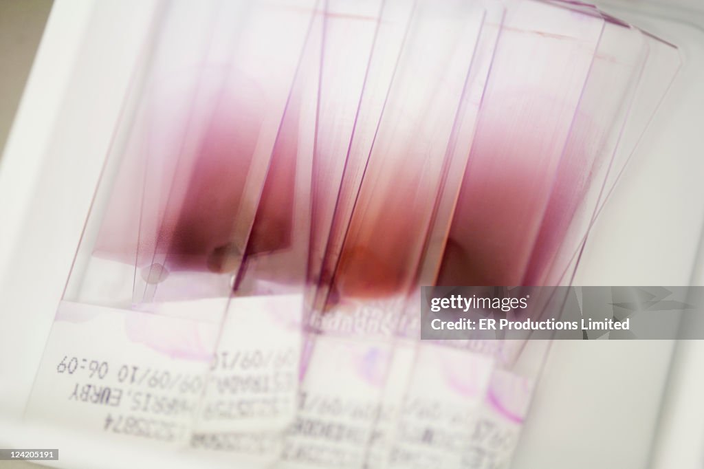 Close up of blood on medical slides