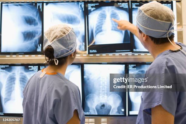 doctors examining chest x-rays - borstkas stockfoto's en -beelden