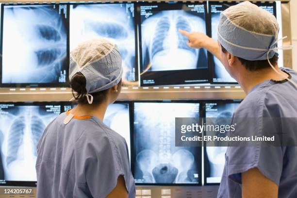 doctors examining chest x-rays - human lung stock pictures, royalty-free photos & images