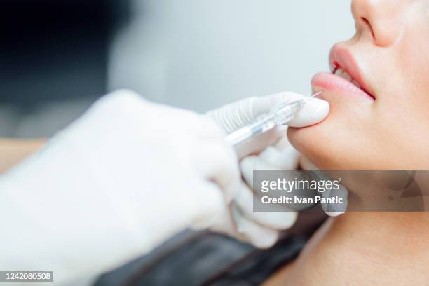 close up of woman receiving botox injection - lip injections stock pictures, royalty-free photos & images