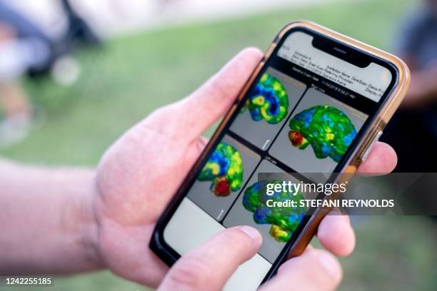 Kevin Hensley, an Iraq and Afghanistan war veteran from Michigan, shows brain scans from medical procedures he had done, outside the US Capitol in...