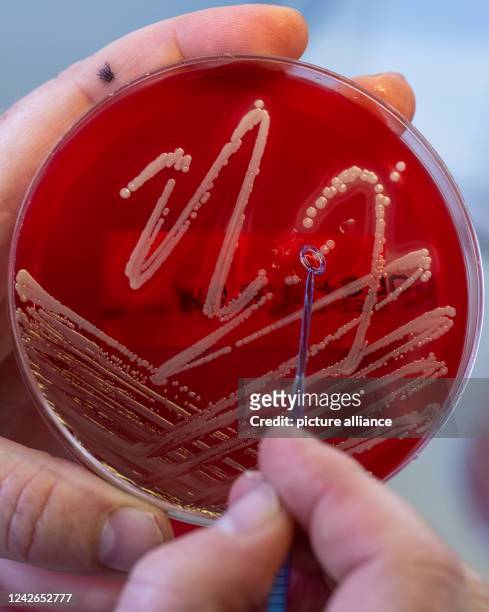 August 2022, Saxony, Chemnitz: A medical-technical assistant prepares utility cultures of the bacterium Staphylococcus aureus in a laboratory at the...