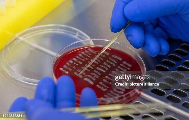 August 2022, Saxony, Chemnitz: A medical-technical assistant prepares Escherichia coli strains for PCR analysis in a laboratory at the Saxony State...