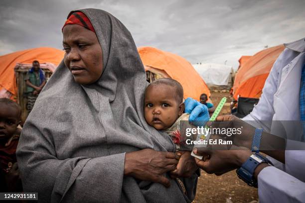 Child is tested for malnutrition in a displacement camp for people impacted by drought on September 3, 2022 in Baidoa, Somalia. Extreme drought has...