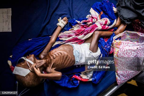 Baby is treated for severe acute malnutrition as Martin Griffiths, Under Secretary General for the United Nations Humanitarian Affairs and Emergency...
