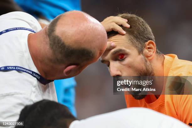 Pau Lopez of Olympique de Marseille is treated for an eye injury during the UEFA Champions League group D match between Tottenham Hotspur and...