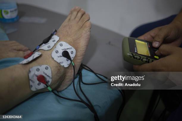 Miguel Segovia, Physiotherapist, places radiotherapy on a patient with an injury, in Caracas, on September 7, 2022. On September 8, the constitution...