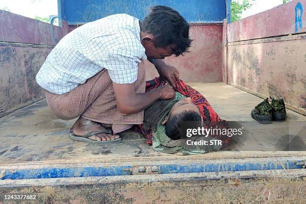 Graphic content / This photo taken on September 17, 2022 shows a young victim of an air strike on a school building in Depeyin township in Myanmar's...