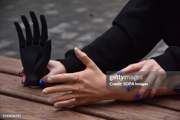 Woman demonstrates a black modern bionic hand prosthesis, an Esper Hand developed by Esper Bionics which will be fitted to Ukrainian military and...