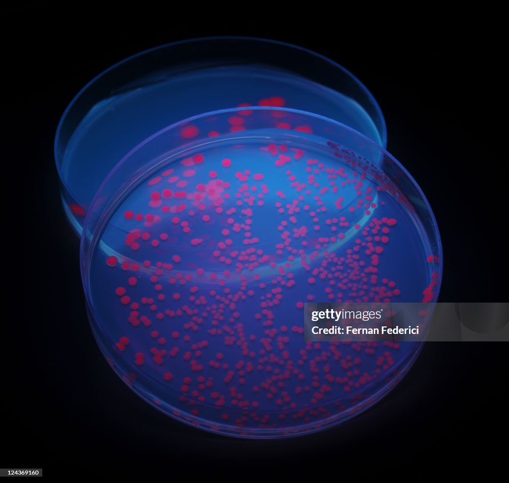 Red fluorescent protein in bacteria