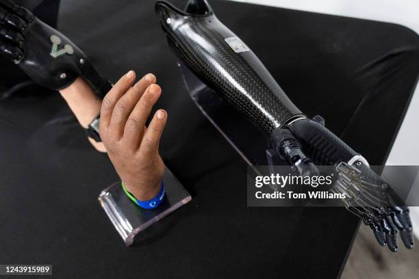 Hand Prosthetic Using Spring's United Prosthetics Inc Photos and Premium High Res Pictures - Getty Images
