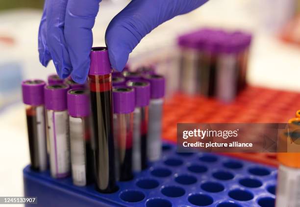 November 2022, Schleswig-Holstein, Kaltenkirchen: An employee of the German Red Cross places a tube of blood from a donor on a table during a blood...