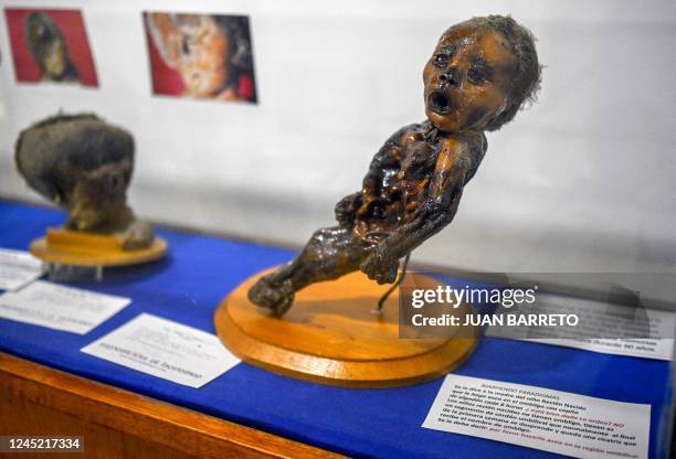 View of a mummified malformed foetus at the Museo del Ser Humano , in Bogota on November 25, 2022. - Deformed fetuses, dissected brains or even...