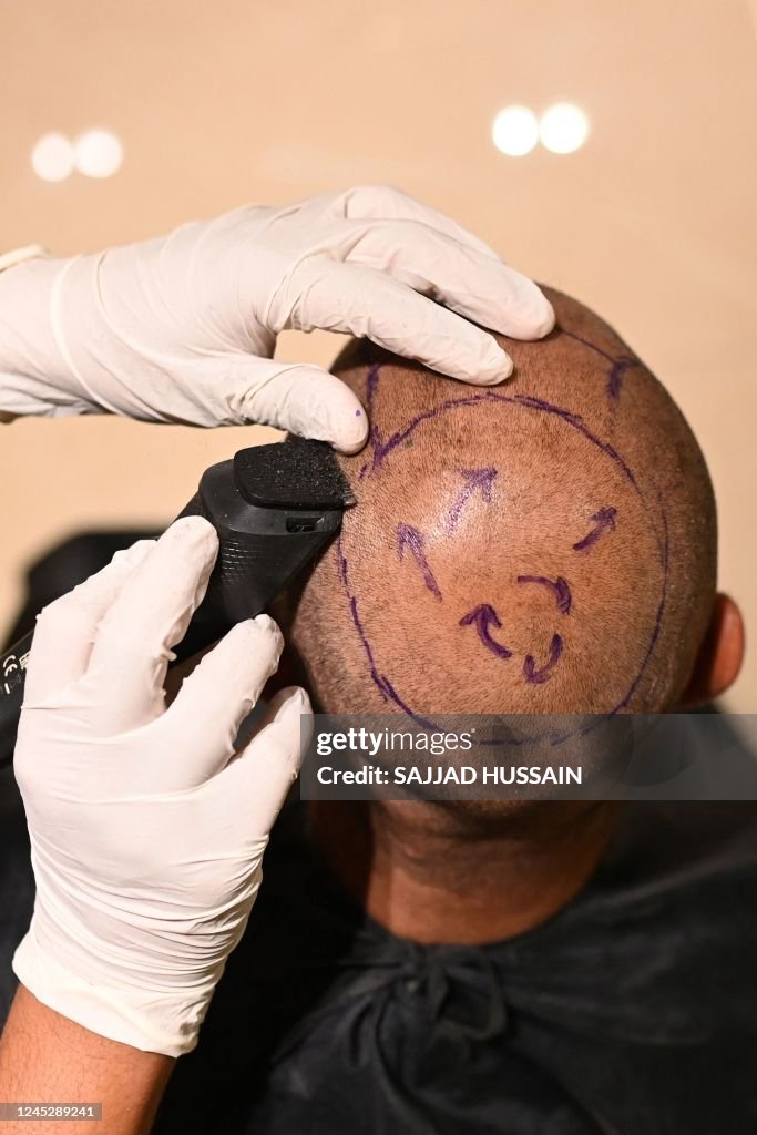 INDIA-GENDER-HEALTH-SOCIAL