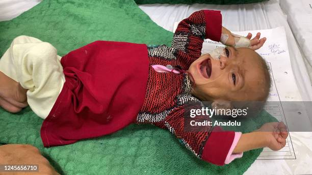 Babies and their mothers, struggling with hunger due to the food crisis, wait for treatment at Mir Veys Hospital as the number of children in clinics...