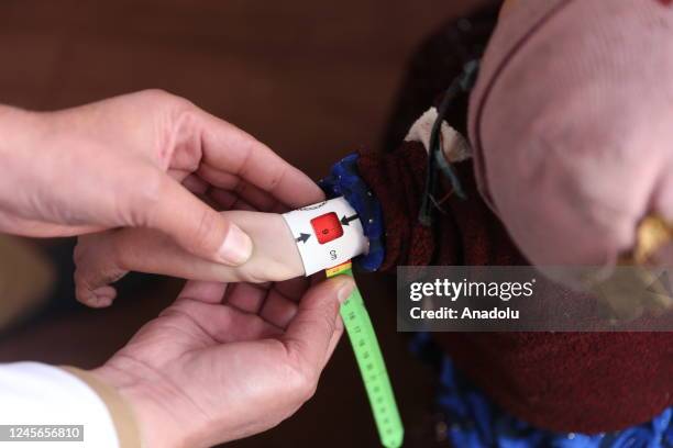 Malnourished 18-month-old Afghan baby Nezmin Terahil is seen during a health check process and treatment at Indira Gandhi Children's Health Hospital...