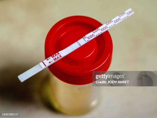 This photograph taken October 14 shows a drugs testing urine sample kit at Felix Eboue international airport in Cayenne, French Guiana. - French...