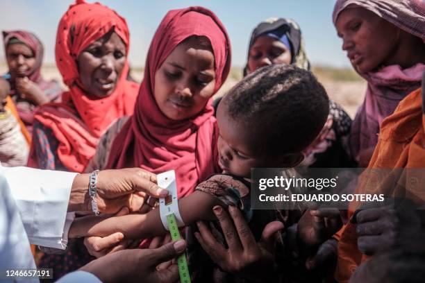 Health worker measures the arm of a child in a mobile clinic set up by NGO Save The Children at the village of Antalale, 50 kilometres from the city...