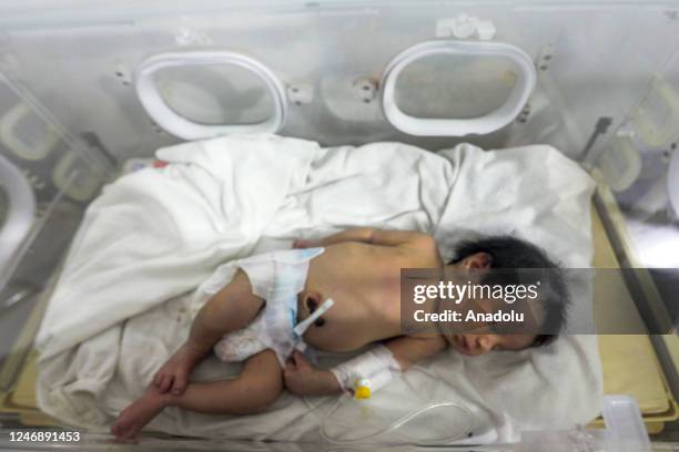 Baby girl, who was born under the rubble in the town of Jinderis located in Syria's Idlib district, receives treatment inside an incubator at a...