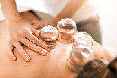 Detail of a woman therapist hands giving cupping treatment