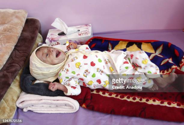 Yemeni baby, suffering from malnutrition, receives treatment with limited resources in the Department of Combating Malnutrition at Sabeen Hospital in...