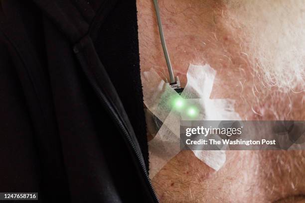 Stentrode recipient Rodney Gorham uses Synchron's brain-computer interface at his home on February 14, 2023 in Moonee Ponds, Melbourne, Australia.