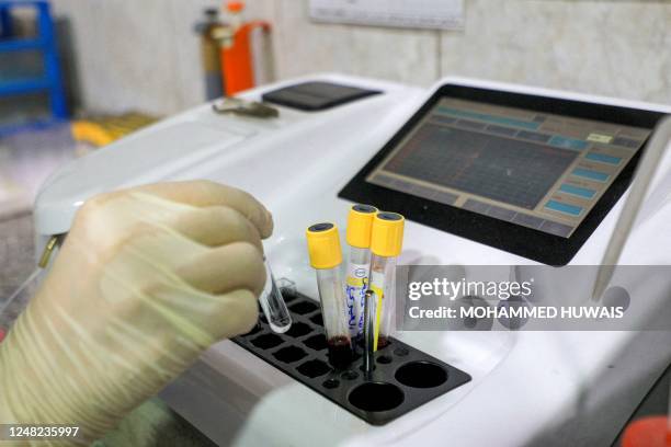 Blood Processing Lab 1,267 Blood Processing Stock Photos, High-Res Pictures, and Images ...