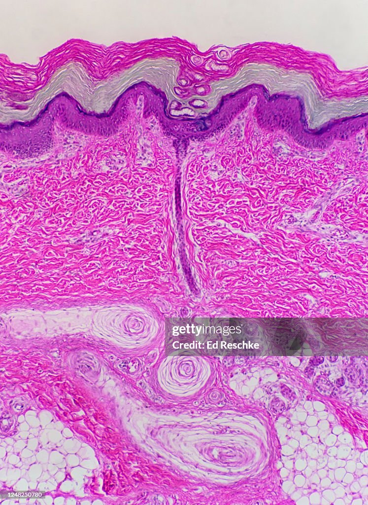 PACINIAN CORPUSCLES in the Subcutaneous Layer of the SKIN (Human) 50X