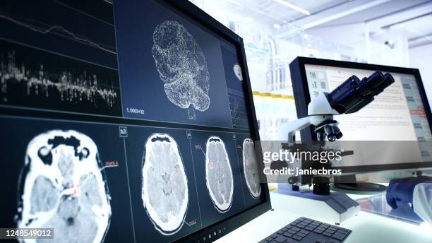 equipo de laboratorio futurista. investigación de escaneo de ondas cerebrales en pantallas de computadoras - nerve fotografías e imágenes de stock