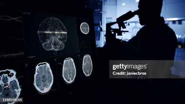 顕微鏡を持つ科学者。コンピュータ画面の脳波走査研究 - 神経科医 ストックフォトと画像