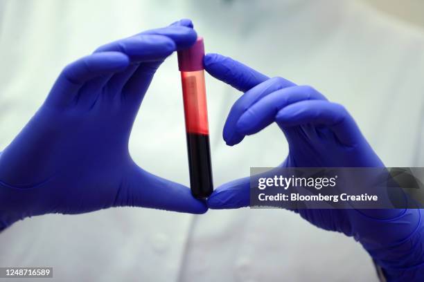 blood sample - análisis-de-sangre-prueba-médica fotografías e imágenes de stock