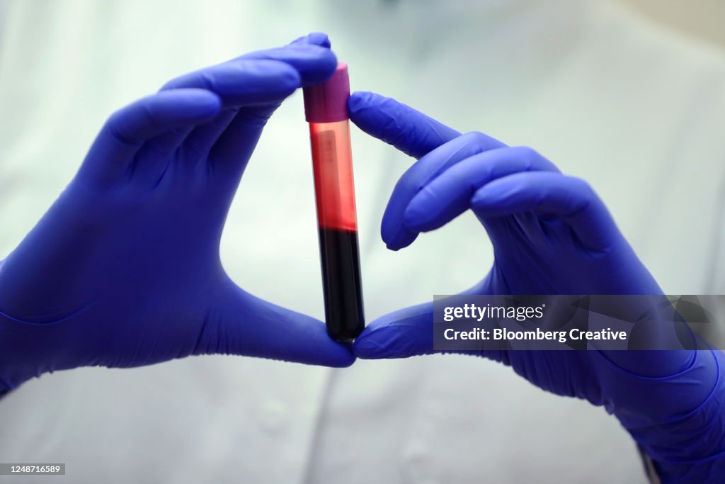 Blood Sample