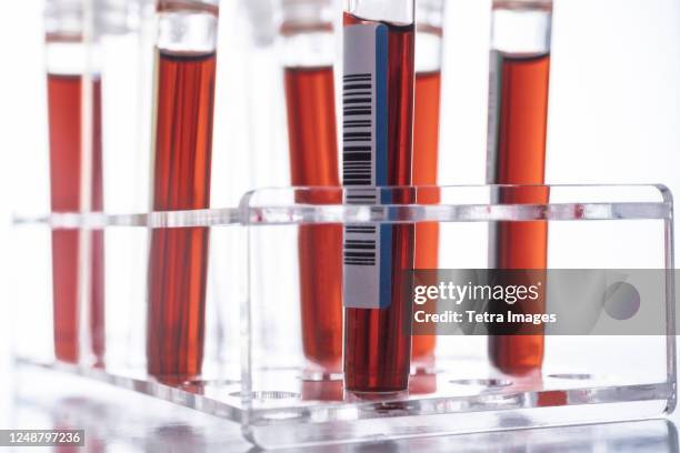 studio shot of covid-19 blood samples in test tube rack - test tube rack stock pictures, royalty-free photos & images