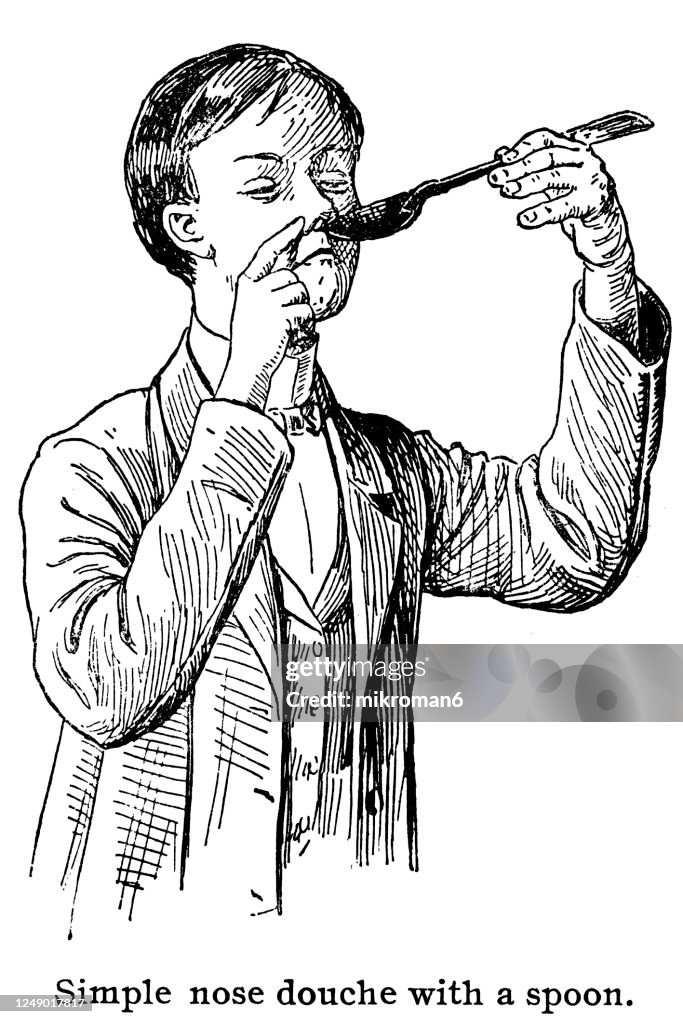 Old engraved illustration of old methods of treating runny nose