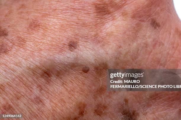 age spots on elderly skin - melanin stock pictures, royalty-free photos & images