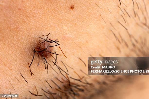 mole on a man's face - naevus stock pictures, royalty-free photos & images