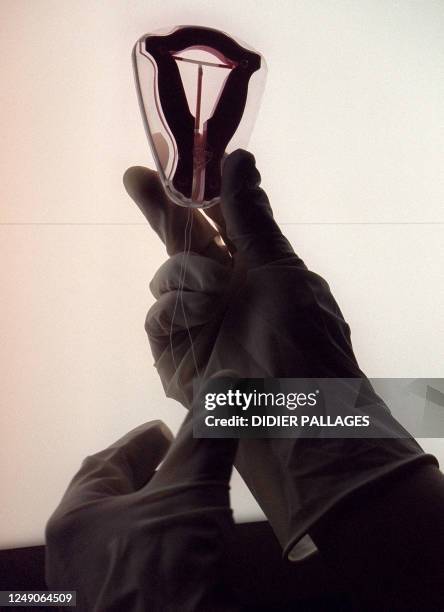 Photo prise le 14 juillet 2001 dans un cabinet médical à Arcueil, près de Paris, d'un stérilet , l'un des modes de contraception pour femmes. Picture...
