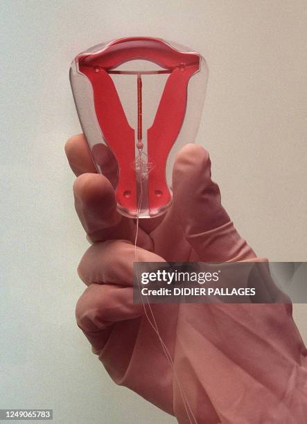 Photo prise le 14 juillet 2001 dans un cabinet médical à Arcueil, près de Paris, d'un stérilet , l'un des modes de contraception pour femmes. Picture...