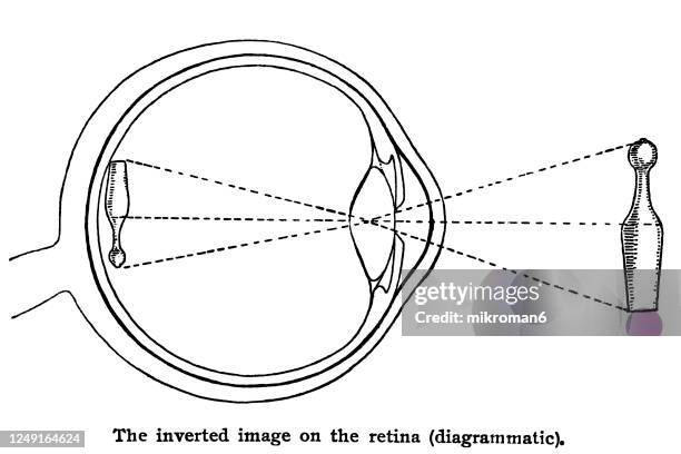 Inversion Color Eye Cornea Eye Diagram Photos and Premium High Res Pictures - Getty Images
