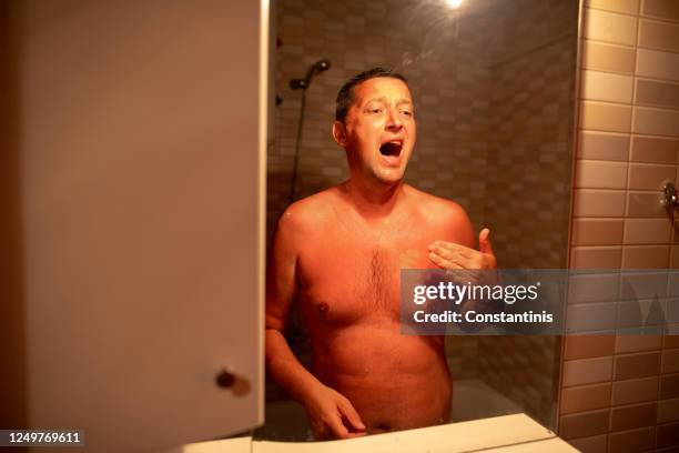 homme avec la peau rougie et démangeant après le coup de soleil - bronzage humour photos et images de collection