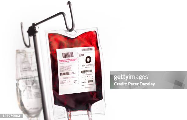 blood and saline bags - blood bag stock-fotos und bilder