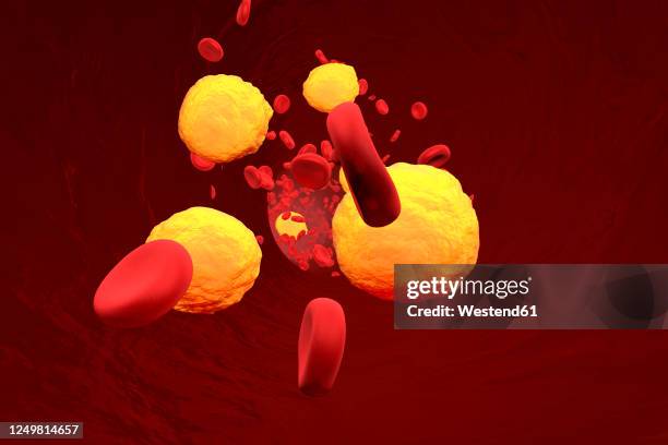 three dimensional render of cholesterol in blood stream - atherosklerose stock-grafiken, -clipart, -cartoons und -symbole